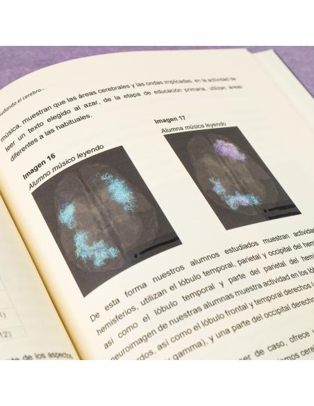 Desnudando el cerebro