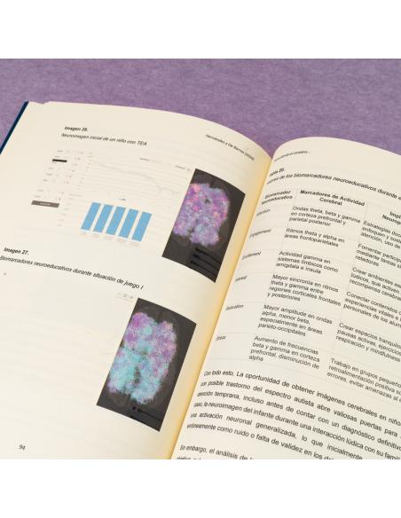 Desnudando el cerebro